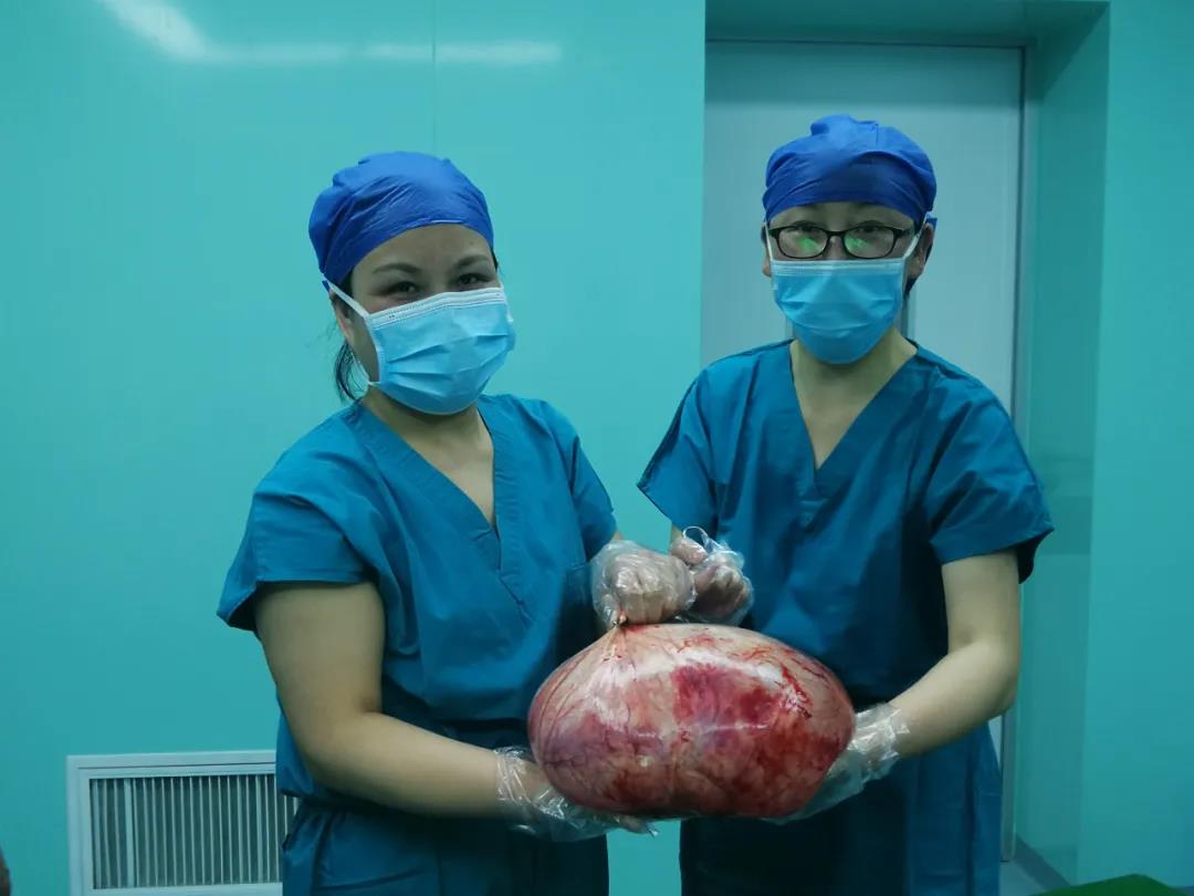 杏林春暖 ▏女子患病3年肚子大如孕妇 医生成功取出12斤巨大肿瘤(图2) 杏林春暖 ▏女子患病3年肚子大如孕妇 医生成功取出12斤巨大肿瘤(图2)